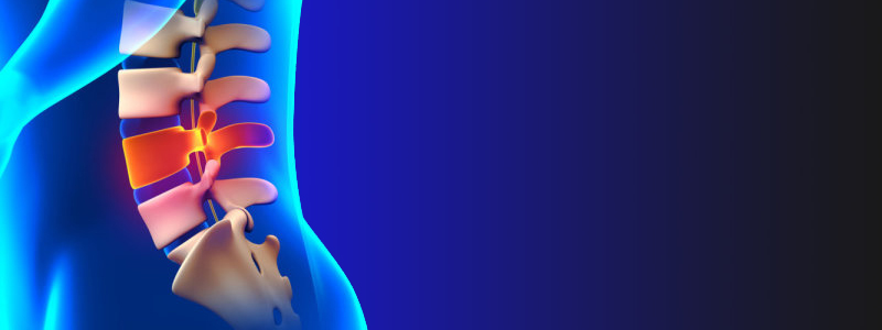 腰椎分離症の治療