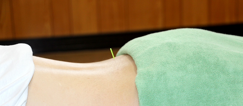 ぎっくり腰の治療