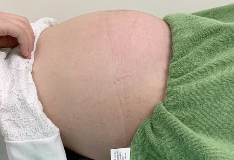 陣痛が来ない時の対処法