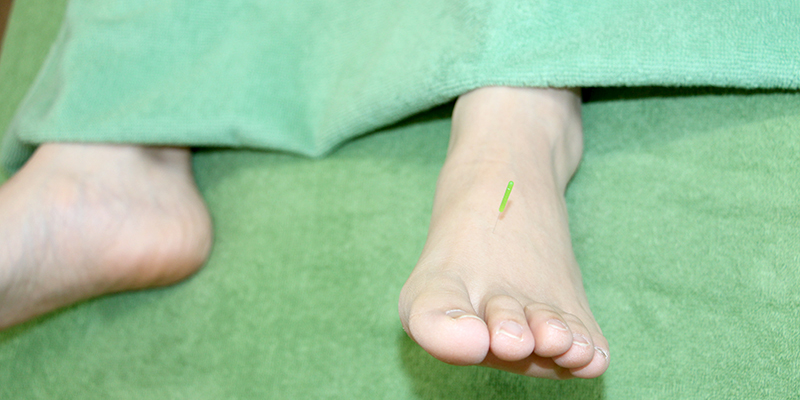 更年期障害の治療