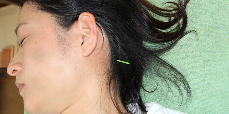 メニエール病の治療