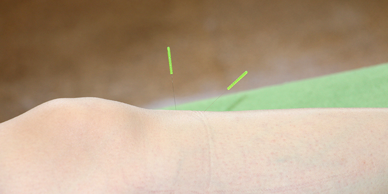 オスグッド病の治療