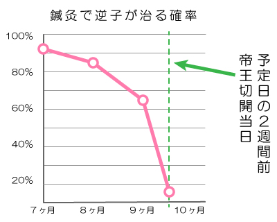 逆子体操で治らない時の逆子治療