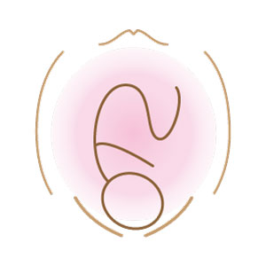 逆子体操で治らない時の逆子治療