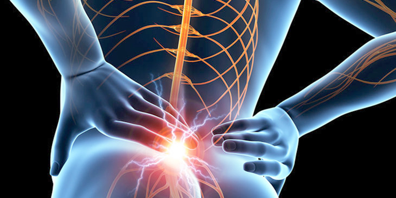 坐骨神経痛の治療