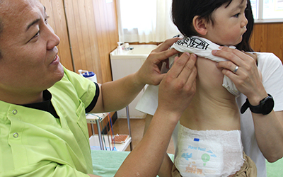 小児喘息の治療